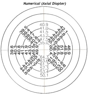 ceratoconeTopograficas8