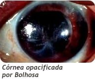 Ceratopatia Bolhosa