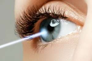 Cirurgia personalizada a Laser