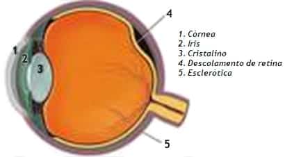 Vítreo e Retina